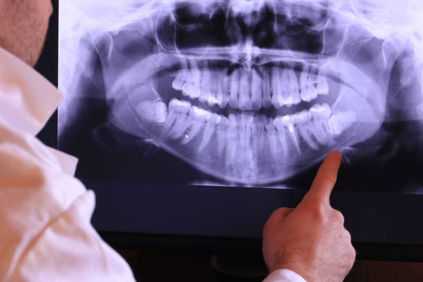 Best Pediatric Emergency Dentist in Pine Bluffs, WY